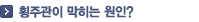 횡주관이 막히는 원인?